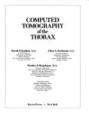 Cover of Computed tomography of the thorax